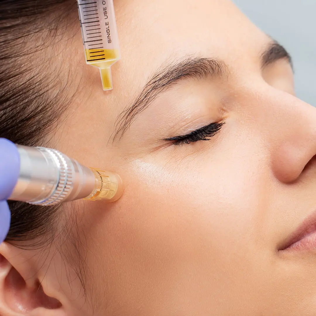 A woman getting her face waxed with an electric device.